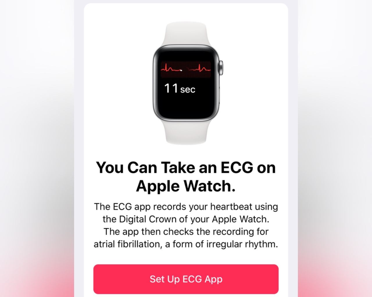 watch os 5.2 ecg
